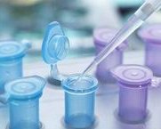 浙江地区的一代试管婴儿技术