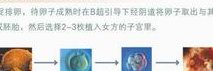 三代试管5bb囊胚成功率高吗？三代试管5bb囊胚的质量如何？